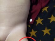 Diduga “Malapraktek Bayi Balita Jadi Korban