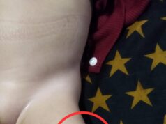 Diduga “Malapraktek Bayi Balita Jadi Korban